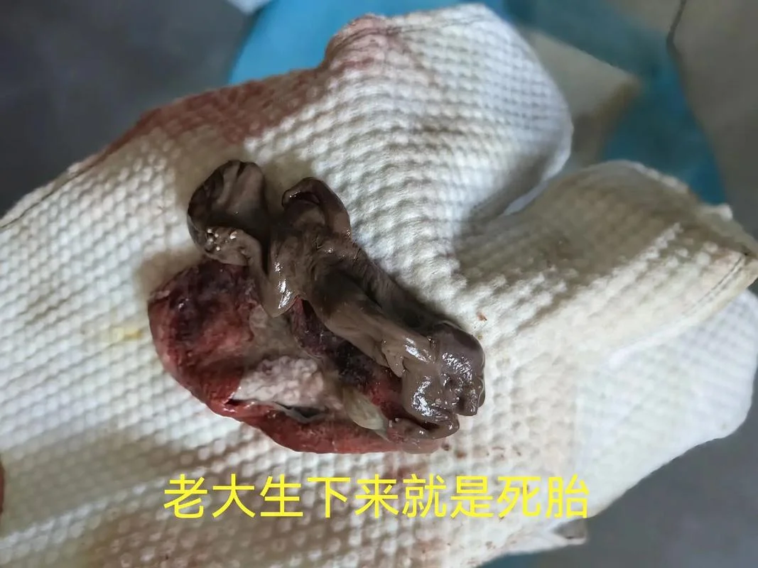 怀孕期间梦见胎儿死亡-怀孕期间梦见胎儿死亡