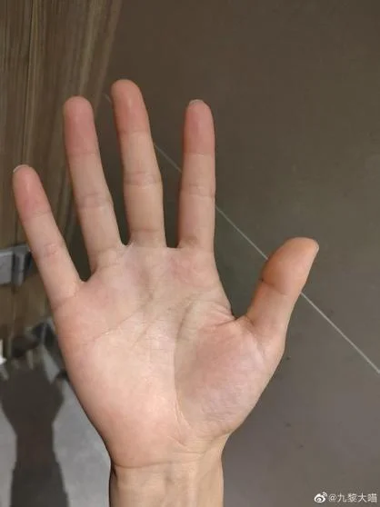 如果有这种小指手相的人_2