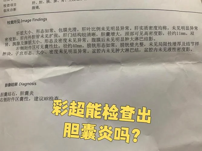 胆囊炎要检查什么项目_2