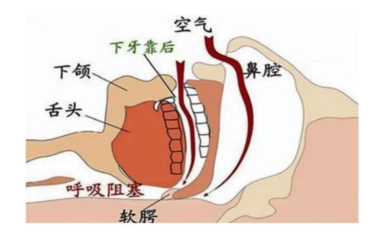 高频振荡呼吸机原理_1