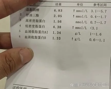 如何查尿酸代谢量_1
