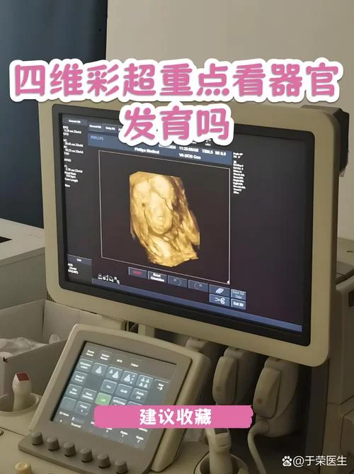 4维彩超要多少钱-4 维彩超价格查询