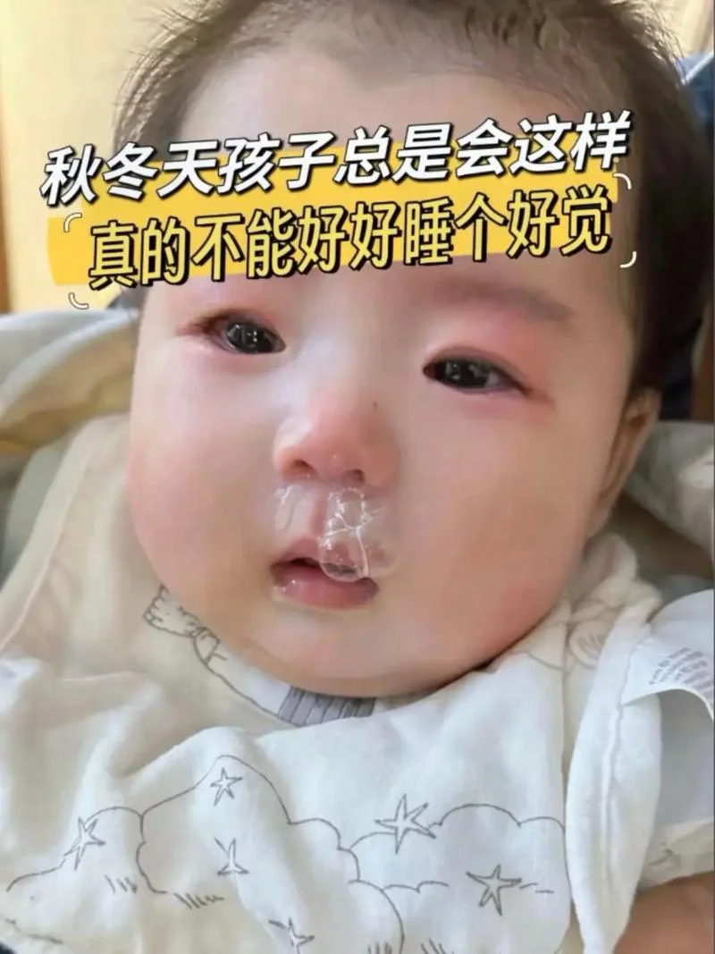 11个月宝宝感冒流鼻涕怎么办-11 个月宝宝感冒流鼻涕怎么办