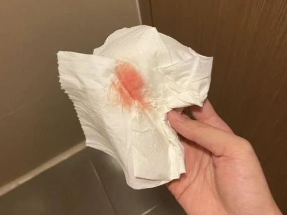 梦到别人流很多的血_2
