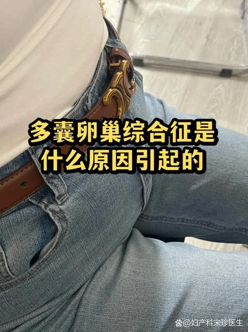 女性多囊是指什么病_2