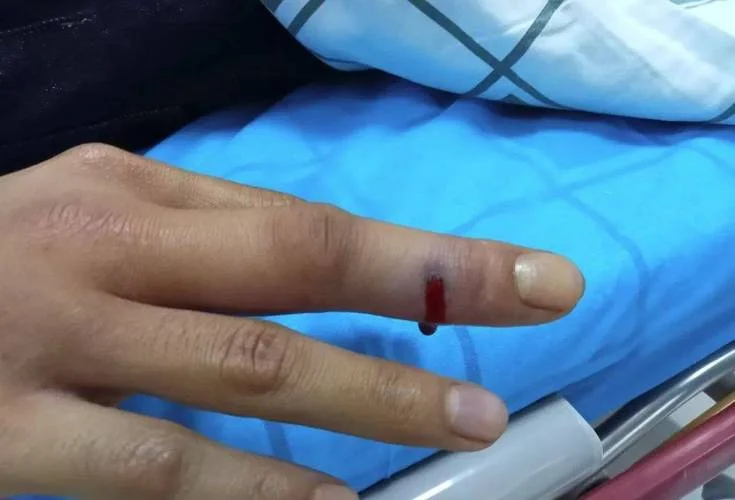 梦见蛇咬自己手指_1