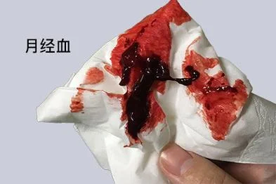做梦来月经很多血_1
