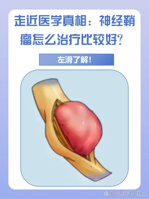 瘤是什么意思_2