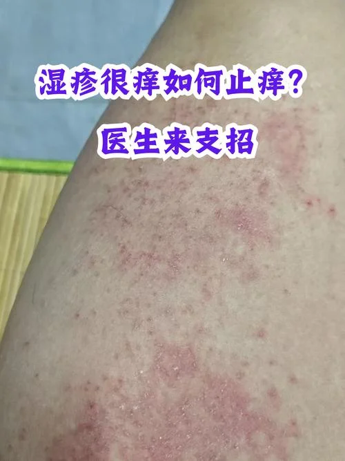 皮肤痒是身体里缺什么_1