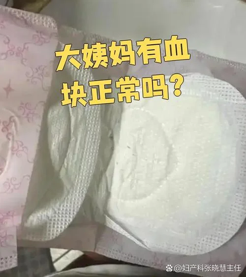 梦见卫生巾上有血块-梦卫生巾血块