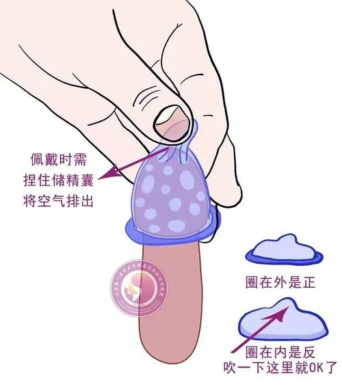 避孕套里面带的震动环怎么用-避孕套内震动环使用