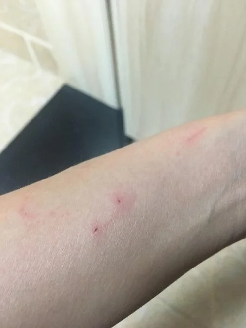 孕妇梦见被猫咬出血_2