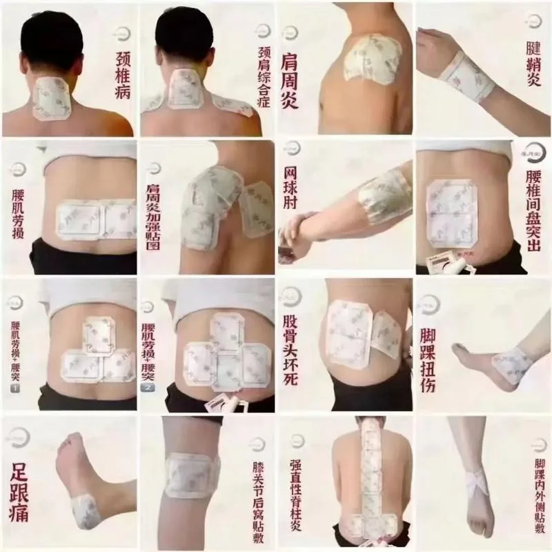 为什么大多骨刺膏是医用冷敷贴_1