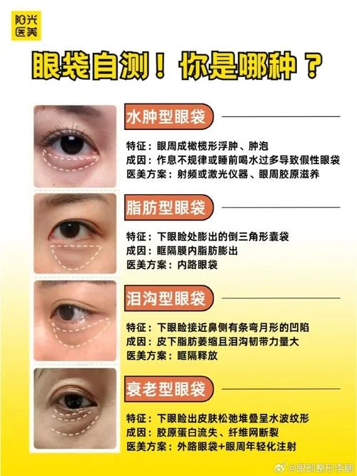 眼袋超级严重怎么办-眼袋严重怎么办