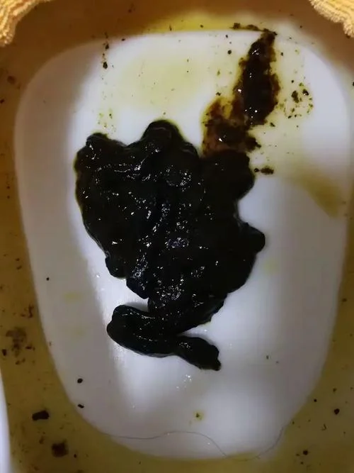 屎黑色颗粒是什么意思_2