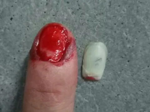 做梦梦到掉指甲_1