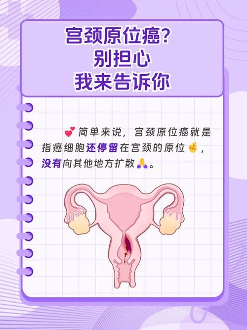 原位癌是什么意思_1