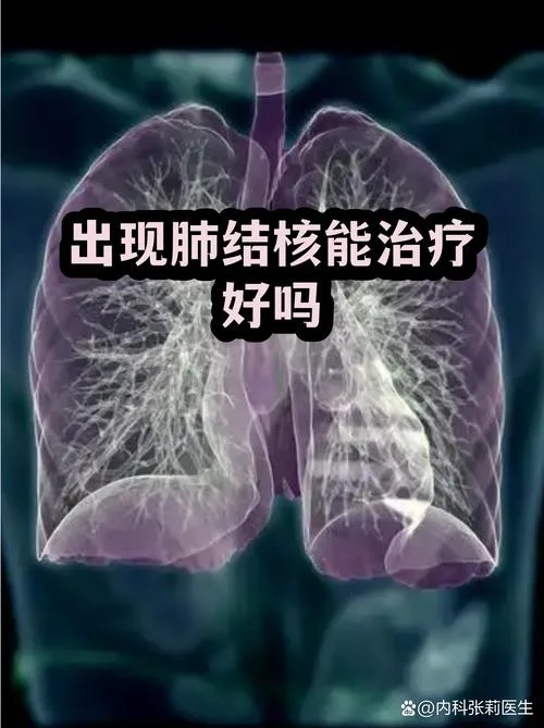 肺痨西医叫什么病_1