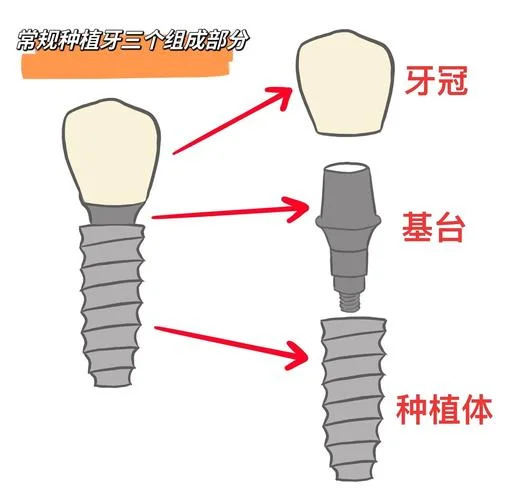 什么是种牙根_1
