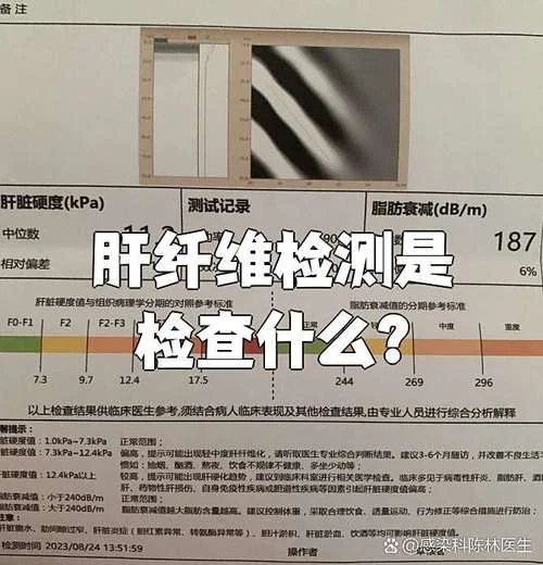 肝纤维化如何查-肝纤维化如何检查