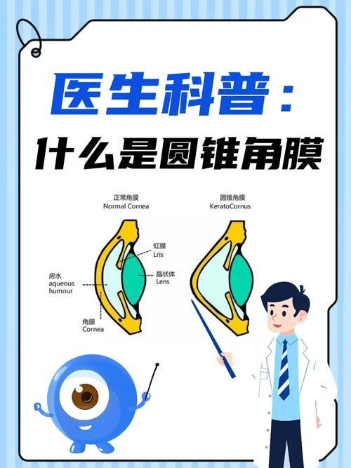 开眼角一个建一个圆_1