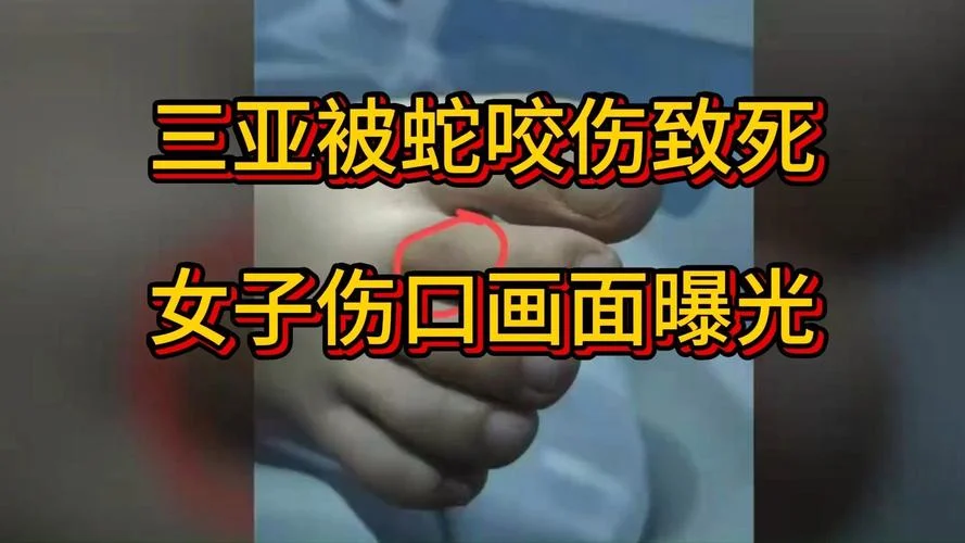 梦见蟒蛇咬人被打死了_1