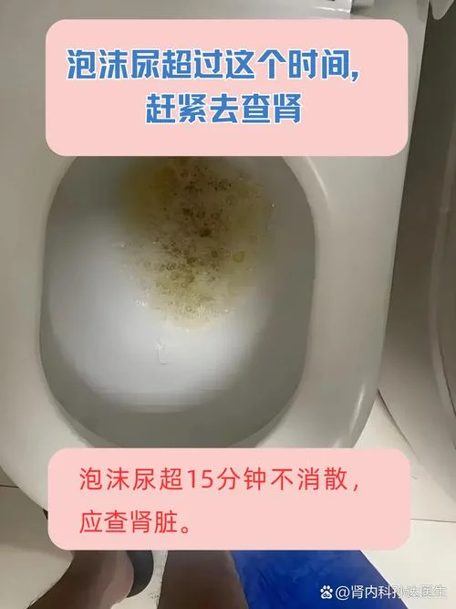梦见老公尿了一大泡尿_2