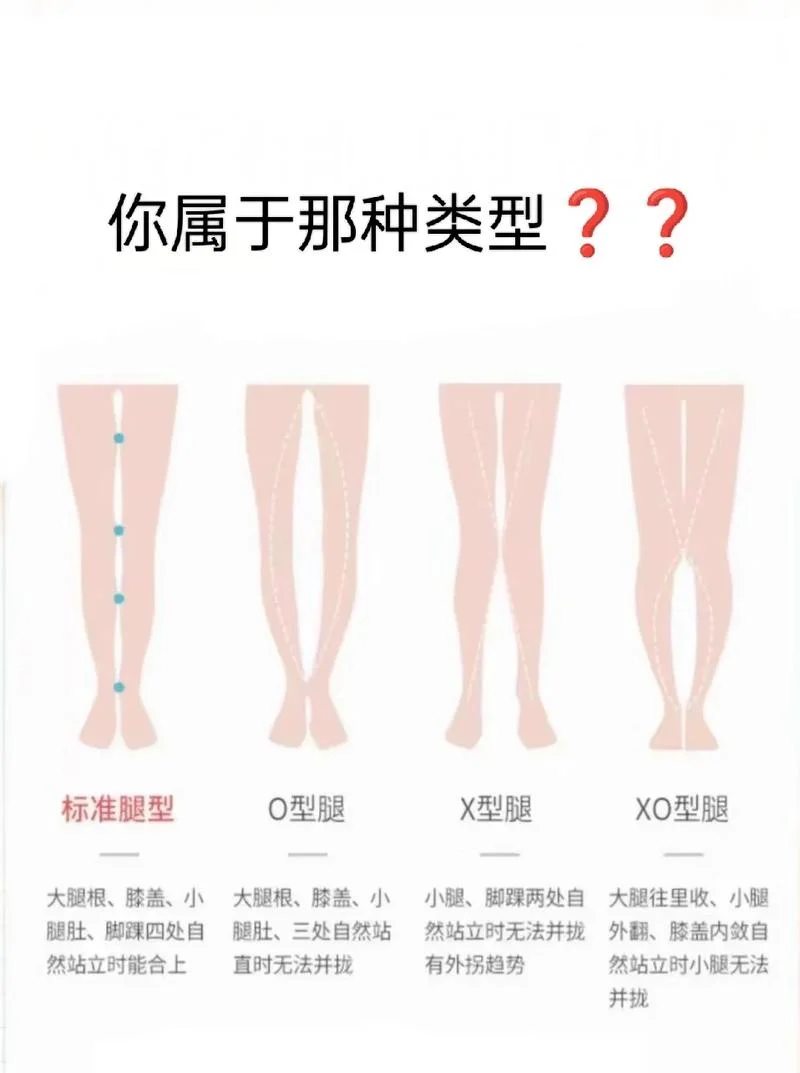 亚长腿型什么意思_1