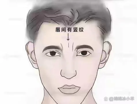 额头两条竖纹叫什么_1