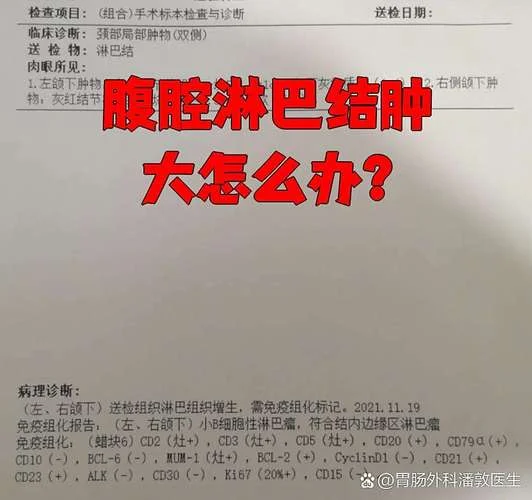 腹腔内多发淋巴结什么意思_1
