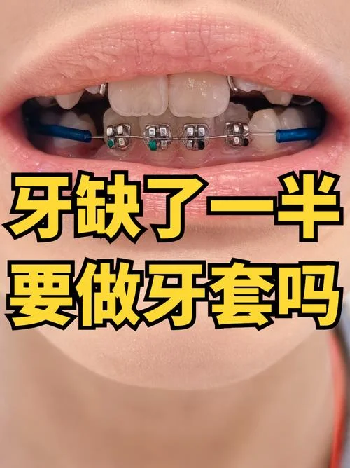 梦见门牙缺了一半-