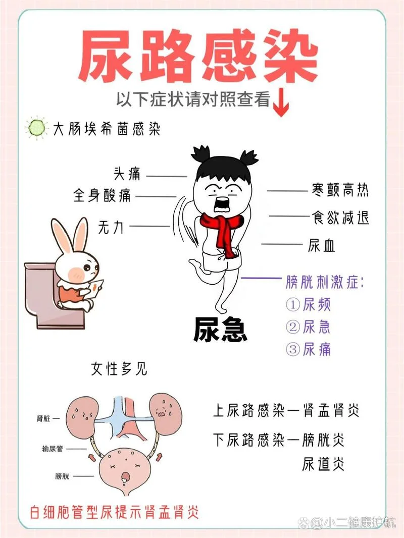 什么是尿路感染女性-女性尿路感染定义