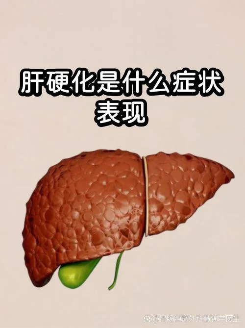 什么是肝硬化?早期肝硬化有哪些症状?_1