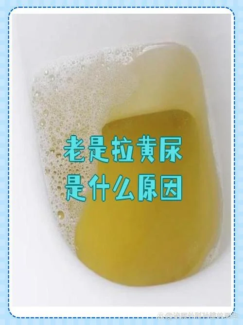 为什么尿尿是很黄很黄的_1