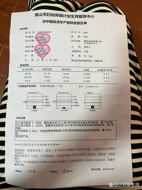 唐氏筛查如何网上查询_2