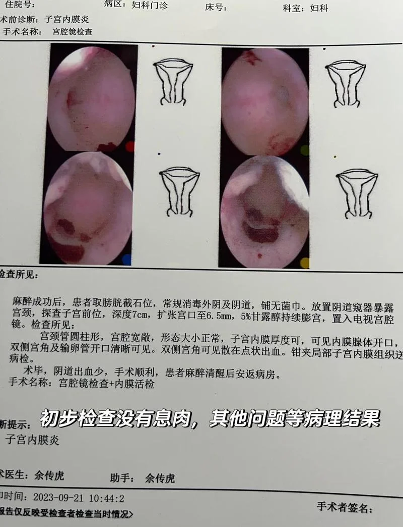 子宫颈抹片是检查什么_1