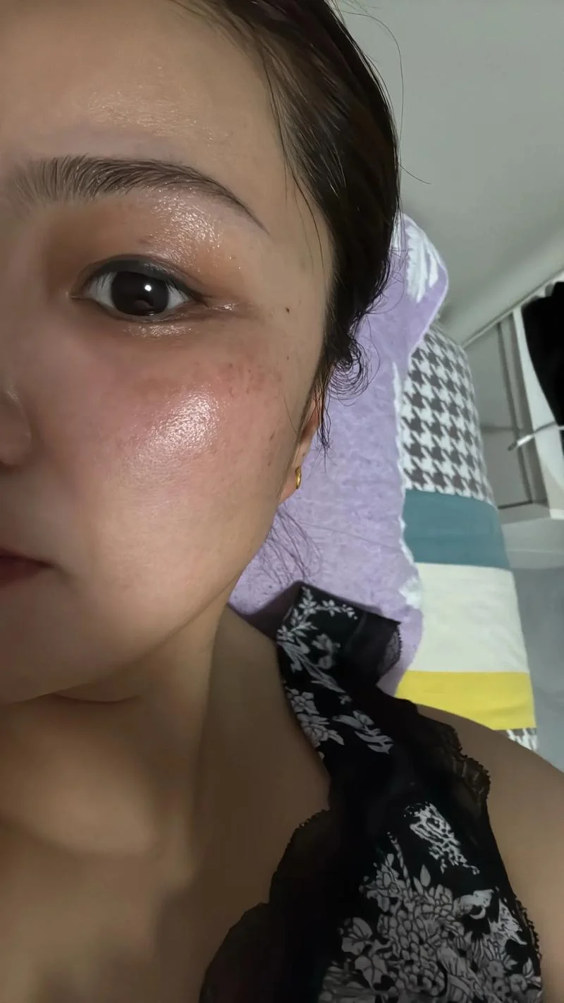 梦见自己脸上斑很明显_2