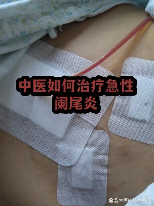 阑尾炎中医叫什么_1