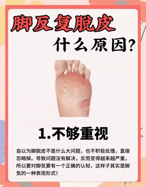 梦见撕脚皮-撕脚皮梦醒