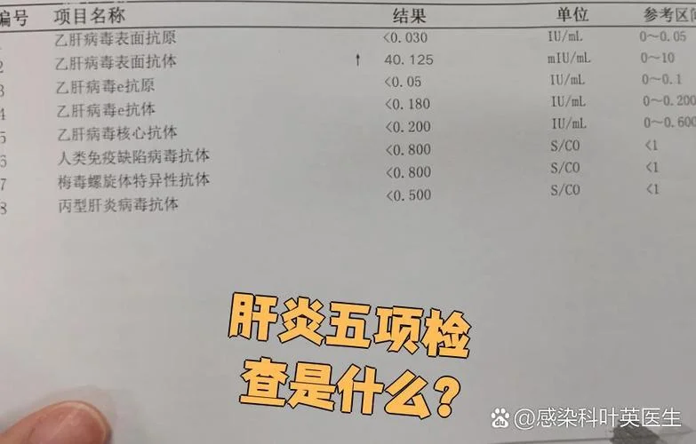 肝炎检查项目包括哪些_1