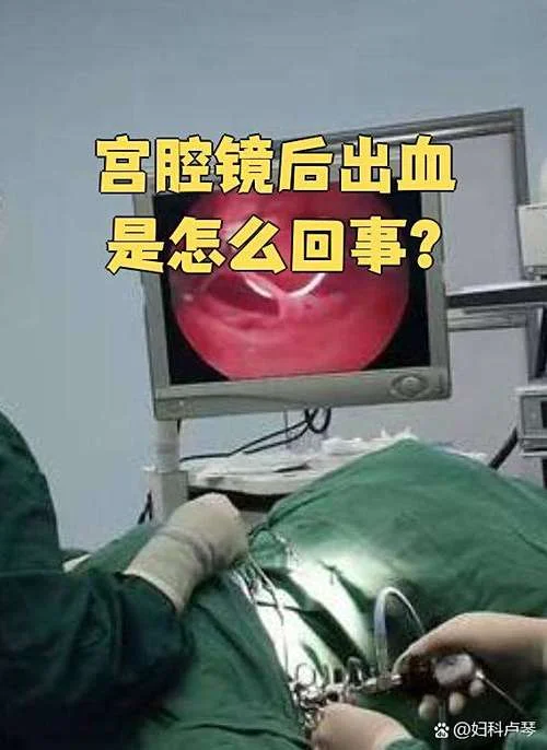子宫出血怎么办-子宫出血怎么办？