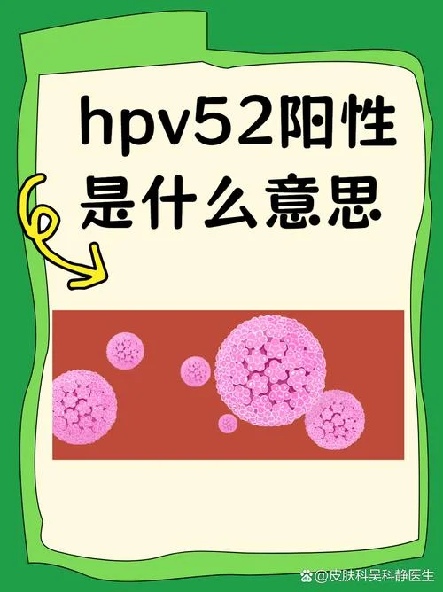 男人如何查hpv52_1