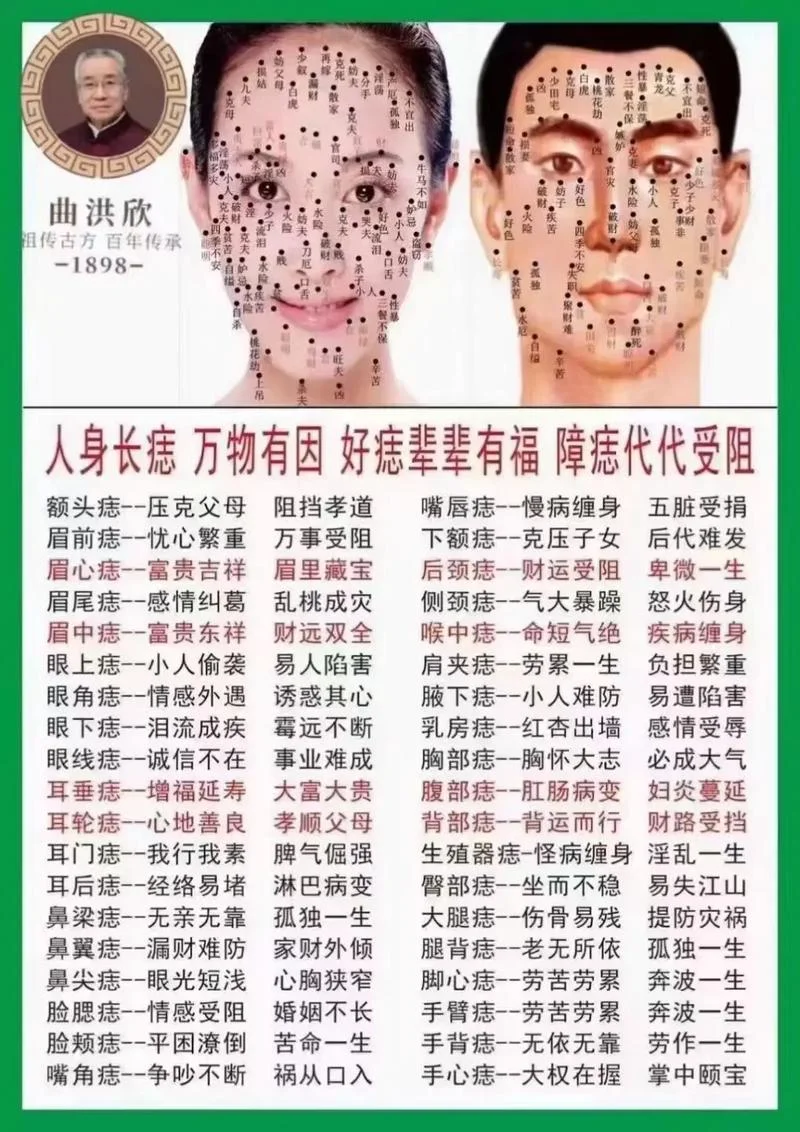 女人脸上的痣图解 命运 面相_1