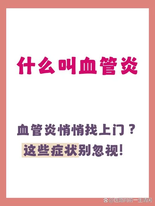 血管炎叫什么_2