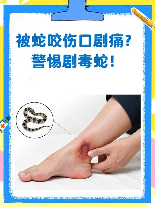 梦见被毒蛇咬伤中毒了_2