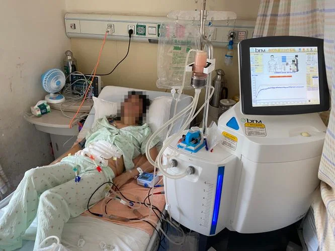 注水腹腔镜检查怎么做-注水腹腔镜检查怎么做