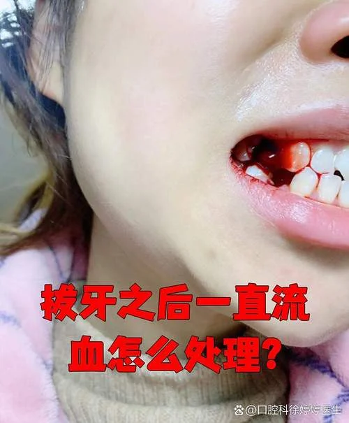 梦见牙齿流血松动-梦齿血松
