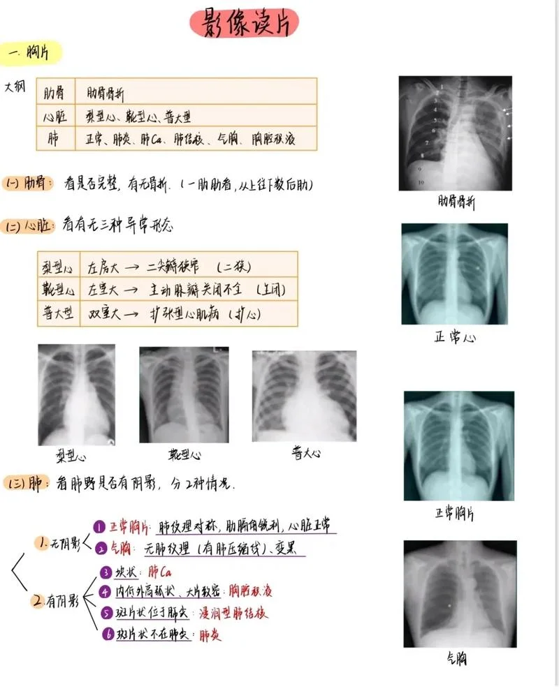 22考研南华大学影像_1