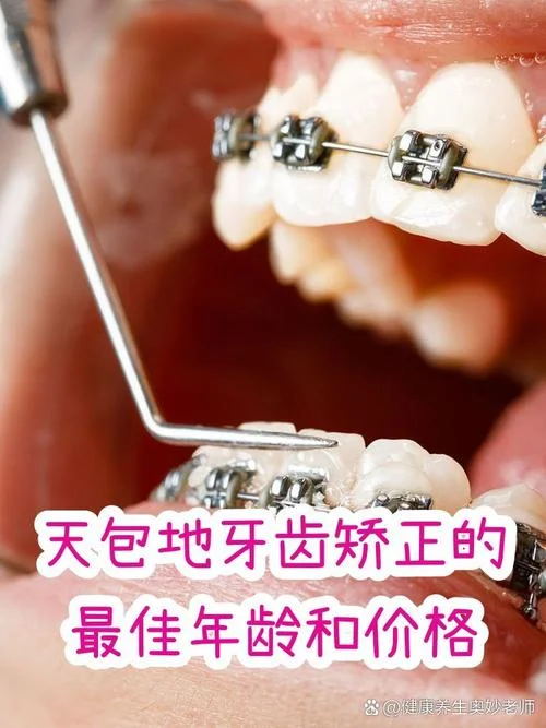 儿童天包地怎么办-儿童天包地怎么办