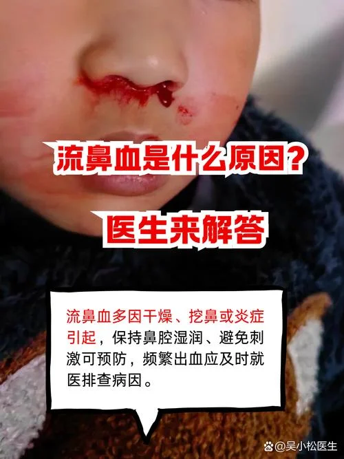 做梦流鼻血周公解梦-关键词：做梦流鼻血周公解梦